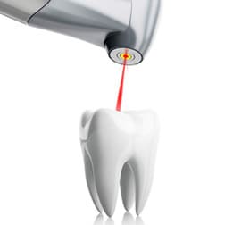 Лазерная стоматология