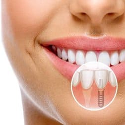 Стоматологическое протезирование клиника Архипова