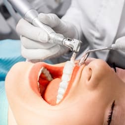 Профессиональная чистка зубов