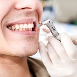 Гигиеническая чистка зубов