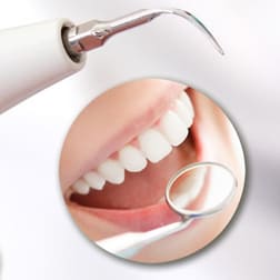 Чистка зубов ультразвуком